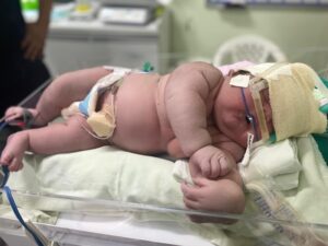 Maior bebê do Amazonas nasce pesando 7kg, em Parintins; hospital lança campanha de doações de fraldas G