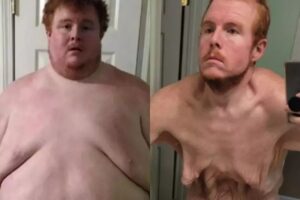 Astro de reality, que pesava 383 kg, diz que era virgem até os 30 anos