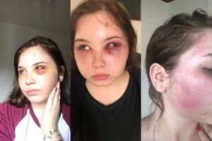 ‘Achei que ia morrer’, diz filha de sertanejo agredida pelo pai