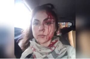 Procurador que espancou chefe tem esquizofrenia paranoide, diz laudo