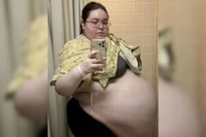 Jovem passa por cirurgia para remover tumor de 45 quilos do ovário