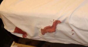 Laudo mostra detalhes do quarto de motel onde modelo matou noivo com tiro na cabeça