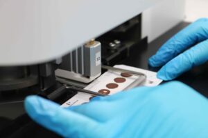 Hemoam implementa sistema que reduz tempo de entrega de testes do pezinho