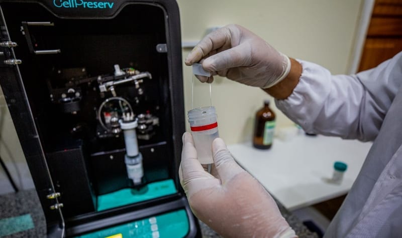 preventivo em meio liquido manaus