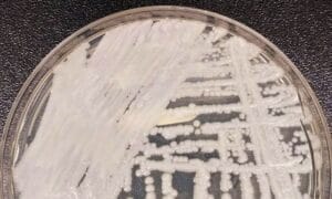 Primeiro caso de superfungo Candida auris é confirmado em São Paulo