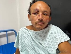 Hospital Platão Araújo procura familiares de paciente sem documentação que foi atropelado