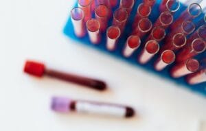 Recepcionista de hospital no AM que recebia material biológico para exames tem direito a adicional de insalubridade