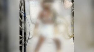 Morre em Manaus o pequeno Éverton Gabriel, a criança que foi gravemente espancada pelo tio