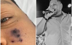 Família diz que cantor de forró morreu após ser picado por aranha: ‘Começou a escurecer o rosto’