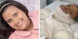 Chocante: mulher de 33 anos morre após sofrer queimaduras enquanto fritava ovo