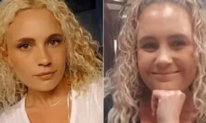 Chocante: bactéria ‘comedora de carne’ mata mulher de 29 anos