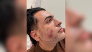 Paciente que morreu em clínica pagou R$ 4.500 por ‘peeling de fenol’