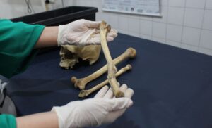 Peritos do Amazonas usam antropologia forense para identificar ossadas humanas
