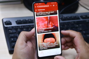 Aplicativo Telestomatologia ajuda a identificar 37 casos suspeitos de câncer bucal no Amazonas