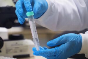 Mpox: Amazonas registra 81 notificações e 18 casos confirmados em novo boletim