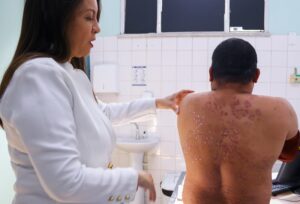Amazonas registra 241 casos de psoríase no primeiro semestre deste ano