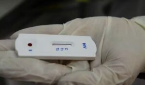 Seis pacientes transplantados no RJ contraem HIV após receberem órgãos contaminados, diz Secretaria de Saúde