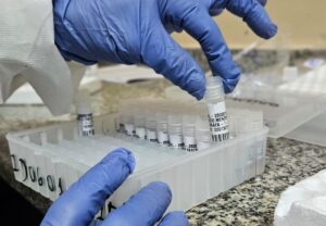 FVS-RCP atualiza informe sobre vírus respiratórios no Amazonas e reforça prevenção