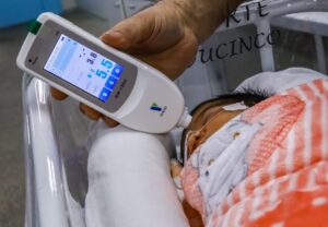 Maternidade Ana Braga adota exame indolor e rápido para icterícia neonatal