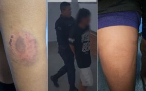 ‘Vítima relatou que sofreu violência durante toda a gestação’, diz PC sobre adolescente estuprada e mantida em cárcere no AM