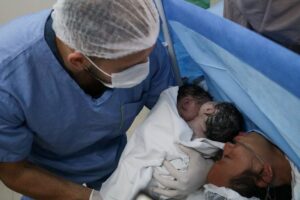 Caso raro: Maternidade Ana Braga realiza parto de gêmeas siamesas unidas pelo abdômen