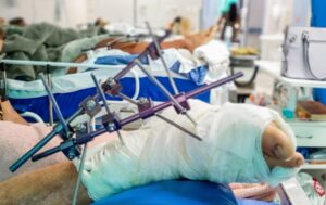 Feriado do Dia do Trabalhador registra 288 atendimentos por acidentes de trânsito em Manaus