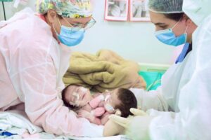 Gêmeas siamesas nascidas na Maternidade Ana Braga são separadas com sucesso em cirurgia em Goiânia