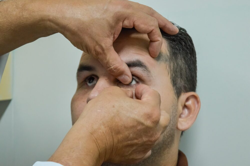 SES AM Pacientes recebem Protese ocular Foto Evandro Seixas SES AM SES AM Pacientes recebem Protese ocular Foto Evandro Seixas SES AM