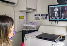 Mais de 3,6 mil exames serão realizados pela Carreta da Saúde nos bairros Dom Pedro e Santo Antônio SES Carreta da Saude Foto Evandro Seixas SES AM ()