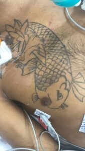 Hospital João Lúcio pede ajuda para identificar paciente em estado gravíssimo com tatuagens
