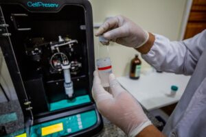 Exames especializados aceleram diagnóstico de câncer de mama e colo do útero em Manaus