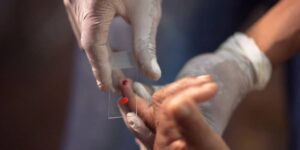 SUS no Amazonas: Brasil é pioneiro no tratamento pediátrico contra malária com tafenoquina