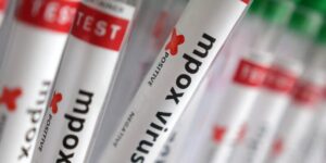 Mpox: casos confirmados no Brasil chegam a 140 em 2026, aponta Ministério da Saúde