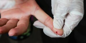 Teste rápido de dengue é incluído na tabela do SUS para diagnóstico mais ágil