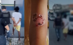 Pai confessa que queimava os próprios filhos para ‘educá-las’ e por estar com raiva’, em Manaus